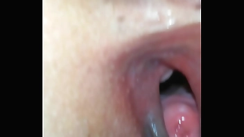 Lồn rộng soi tử cung